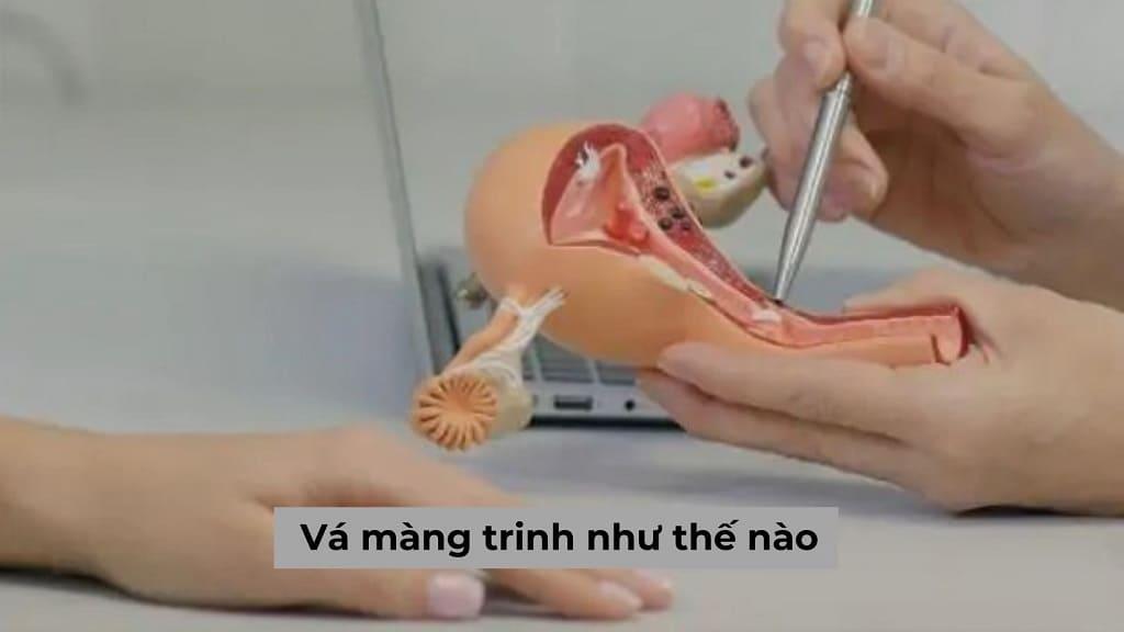 Quy trình vá màng trinh như thế nào, thực hiện ở địa chỉ nào ở Hà Nội thì an toàn?