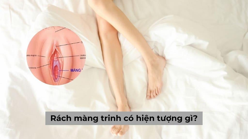 [Bác sĩ giải đáp] Rách màng trinh có hiện tượng gì? 