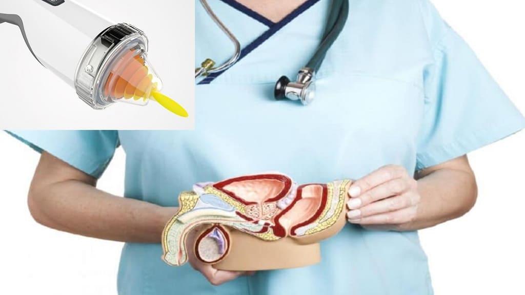 Tìm hiểu toàn diện về điều trị rối loạn cương dương bằng sóng xung kích