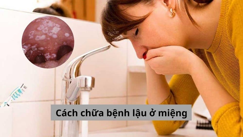 Cách chữa bệnh lậu ở miệng tại nhà liệu có nên áp dụng?