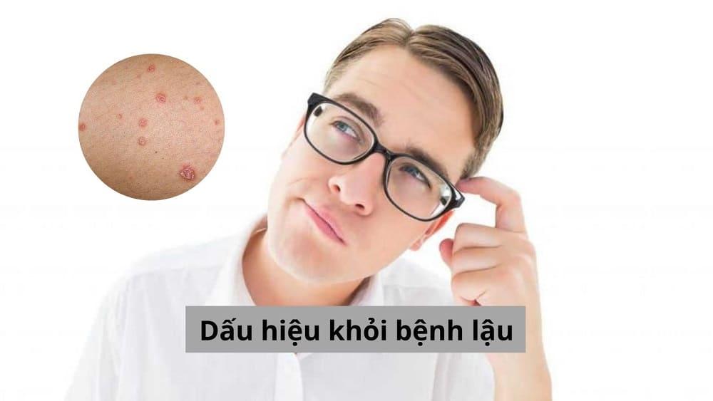 Dấu hiệu khỏi bệnh lậu thường sau điều trị bao lâu và nhận diện như thế nào?