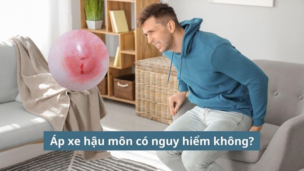 [GIẢI ĐÁP BỆNH LÝ] Áp xe hậu môn có nguy hiểm không?