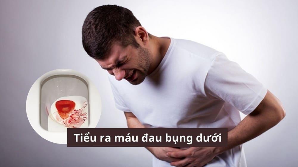 Người bị tiểu ra máu đau bụng dưới có phải mắc bệnh nguy hiểm không?
