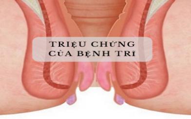 Các triệu chứng bệnh trĩ cần đi khám ngay trước khi quá muộn