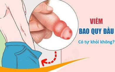 Viêm bao quy đầu có tự khỏi không, nên điều trị thế nào tốt nhất?