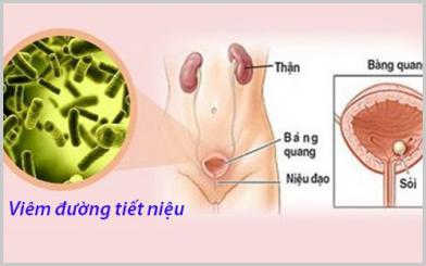 Viêm đường tiết niệu có nguy hiểm không? Cách điều trị hiệu quả