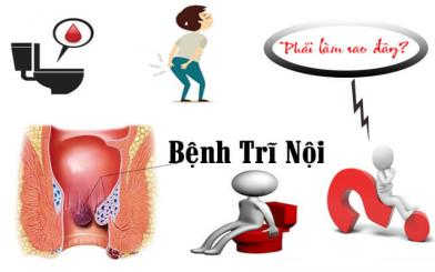 Cắt trĩ nội có đau không? Phương pháp cắt trĩ tốt nhất hiện nay?