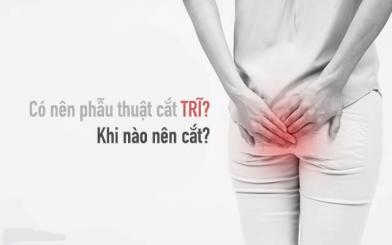 Có nên phẫu thuật cắt trĩ? Cắt trĩ bằng phương pháp nào?