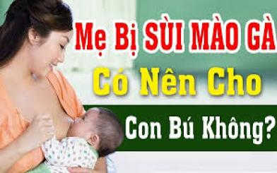 Mẹ bị sùi mào gà có cho con bú được không [Tham khảo]