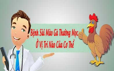 Sùi mào gà thường mọc ở đâu? Có chữa được không?