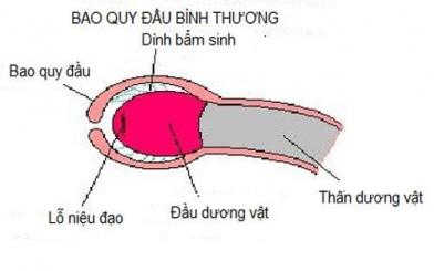 Bao quy đầu bị dính: Nguyên nhân, triệu chứng, cách điều trị