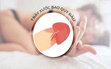 Xước da bao quy đầu: 6 nguyên nhân và 5 cách chữa