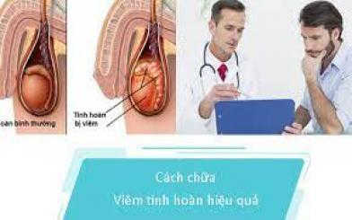 Cách xử lý viêm tinh hoàn hiệu quả và an toàn