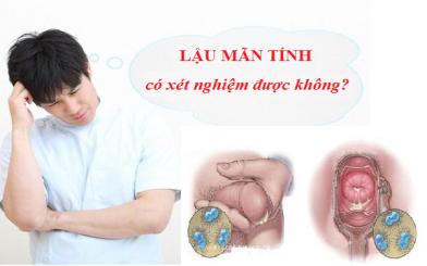 Giải đáp: Lậu mãn tính có xét nghiệm được không?