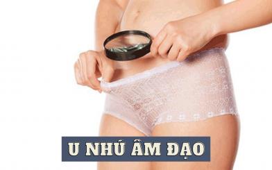 U nhú âm đạo có nguy hiểm không? Làm sao để chữa?