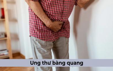 Ung thư bàng quang: Nguyên nhân, dấu hiệu và cách chữa trị