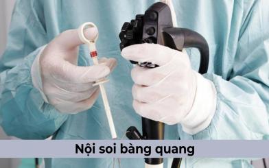 Những điều cần biết về thủ thuật nội soi bàng quang