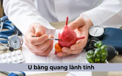 U bàng quang lành tính: Nguyên nhân, triệu chứng, cách điều trị