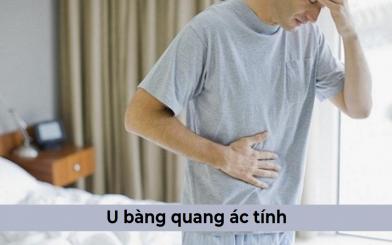 Những vấn đề mà bạn cần biết về bệnh u bàng quang ác tính