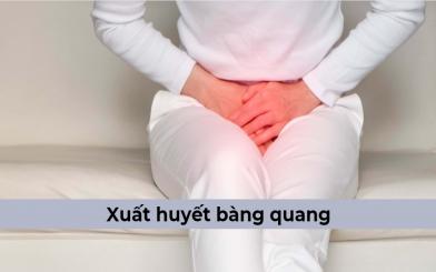 [Tìm hiểu] Hiện tượng xuất huyết bàng quang và cách điều trị hiệu quả