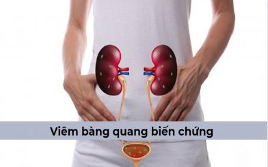 Viêm bàng quang biến chứng nguy hiểm cần thận trọng