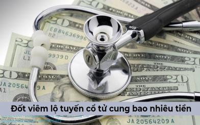 Chi phí đốt viêm lộ tuyến cổ tử cung bao nhiêu tiền? [Bảng giá chi tiết]