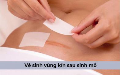 Những cách vệ sinh vùng kín sau sinh mổ an toàn, hiệu quả bạn nên biết