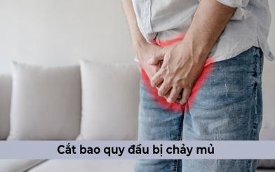 Cắt bao quy đầu bị chảy mủ có sao không?