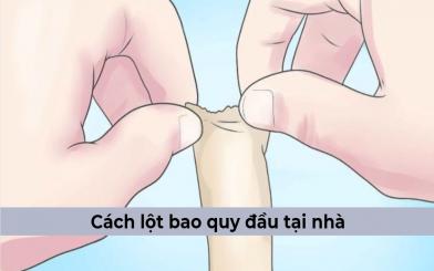 Cách lột bao quy đầu tại nhà thực hiện như thế nào? Bật mí phương pháp an toàn