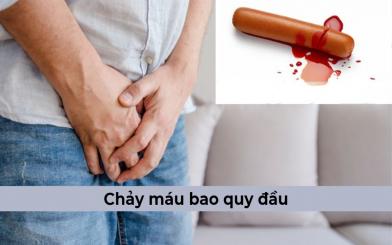 Chảy máu bao quy đầu là bệnh gì? Nam giới nên làm khi khi bị chảy máu