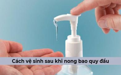 Cách vệ sinh sau khi nong bao quy đầu như thế nào là tốt nhất?