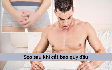 Bị sẹo sau khi cắt bao quy đầu có sao không & khắc phục như thế nào? 