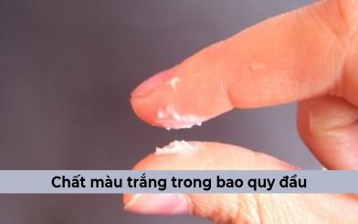 Chất màu trắng trong bao quy đầu là bị gì, có nguy hiểm không? [Giải đáp] 