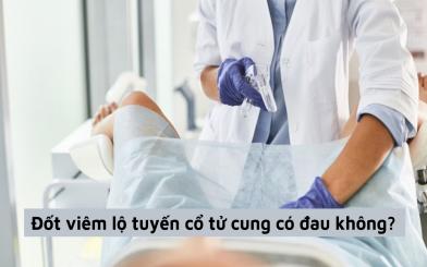 Giải đáp thắc mắc của nữ giới: Đốt viêm lộ tuyến cổ tử cung có đau không?