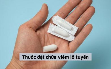 Khi nào dùng thuốc đặt chữa viêm lộ tuyến, 5 loại thuốc hiệu quả nhất