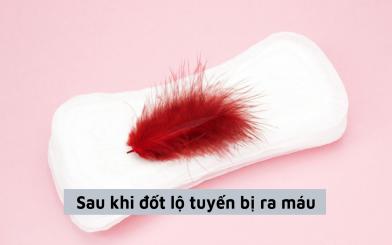 Vì sao sau khi đốt lộ tuyến bị ra máu, cách khắc phục?