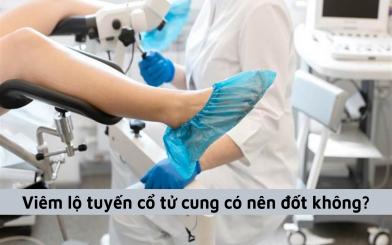 Nữ giới thắc mắc: Nếu bị viêm lộ tuyến cổ tử cung có nên đốt không?