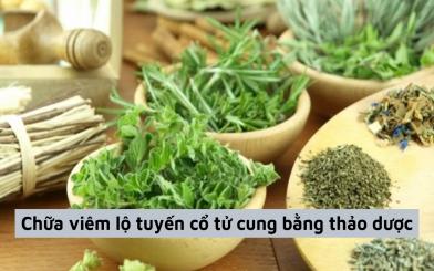 [REVIEW] Phương pháp chữa viêm lộ tuyến cổ tử cung bằng thảo dược hiệu quả cao