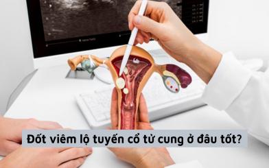 Top những địa chỉ đốt viêm lộ tuyến cổ tử cung ở đâu tốt nhất?