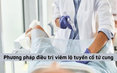 Tìm hiểu và tổng hợp các phương pháp điều trị bệnh viêm lộ tuyến cổ tử cung