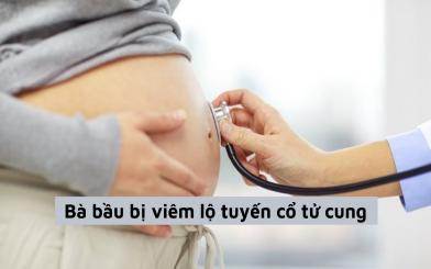 Bà bầu bị viêm lộ tuyến cổ tử cung liệu có nguy hiểm không?