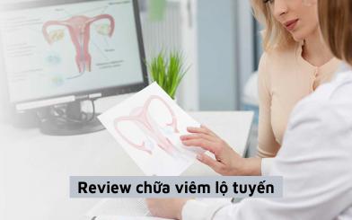 Review chữa viêm lộ tuyến tại địa chỉ uy tín Hà Nội