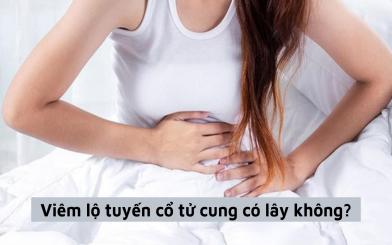 Viêm lộ tuyến cổ tử cung có lây không, chữa như thế nào hiệu quả?