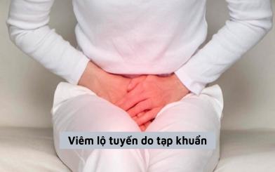 Tìm hiểu về viêm lộ tuyến do tạp khuẩn và đề xuất cách điều trị hiệu quả