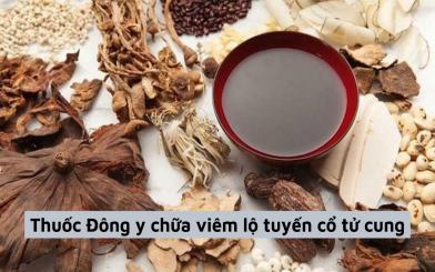 Thuốc Đông y chữa viêm lộ tuyến cổ tử cung liệu có tốt? Top 5 bài thuốc hiệu quả