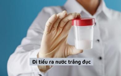 Đi tiểu ra nước trắng đục: Nguyên nhân, biến chứng và cách điều trị