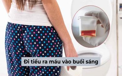 Đi tiểu ra máu vào buổi sáng cảnh báo bệnh nguy hiểm nào?