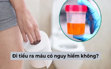 Giải đáp nhanh: Hiện tượng đi tiểu ra máu có nguy hiểm không, chữa bằng cách nào?