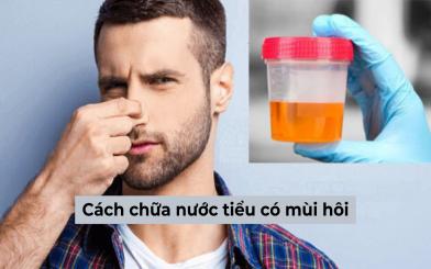 Cách chữa nước tiểu có mùi hôi bạn chắc chắn không nên bỏ qua