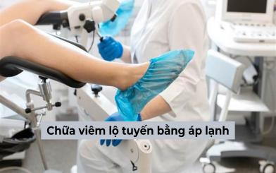 Chữa viêm lộ tuyến bằng áp lạnh có hiệu quả không?